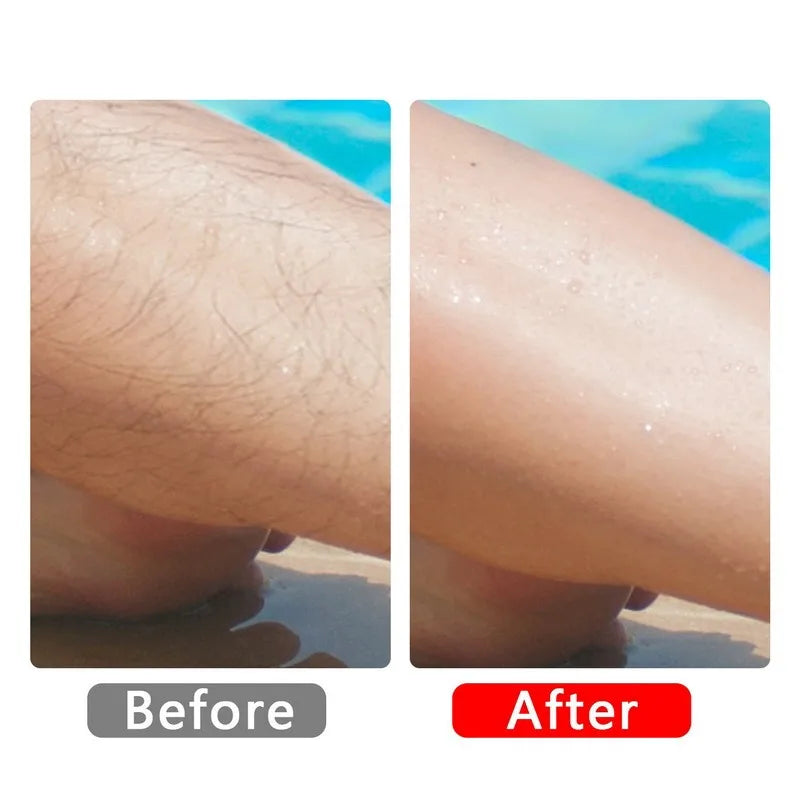Painless Crystal Hair Removal